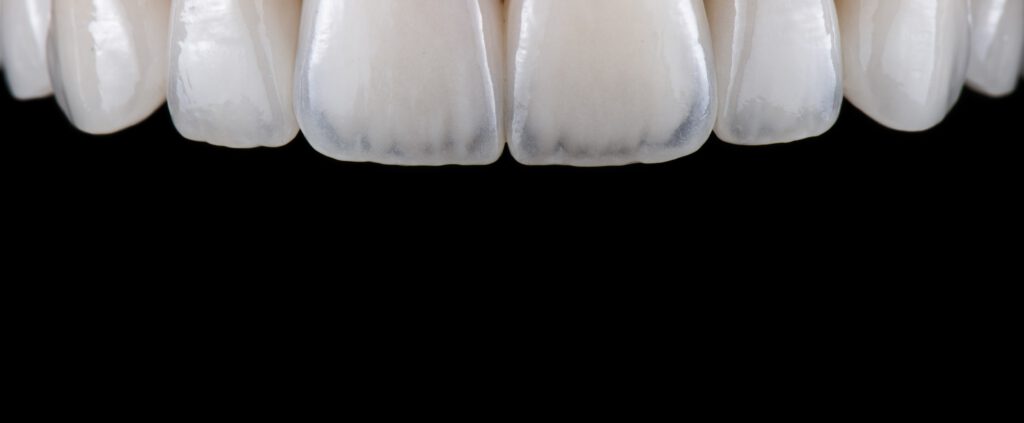 Ästhetische Zahnheilkunde – Komplettsanierung